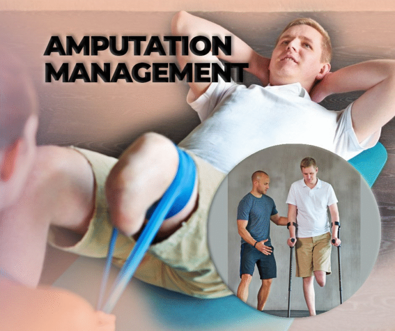 Management of Leg Amputation: A Comprehension Guide