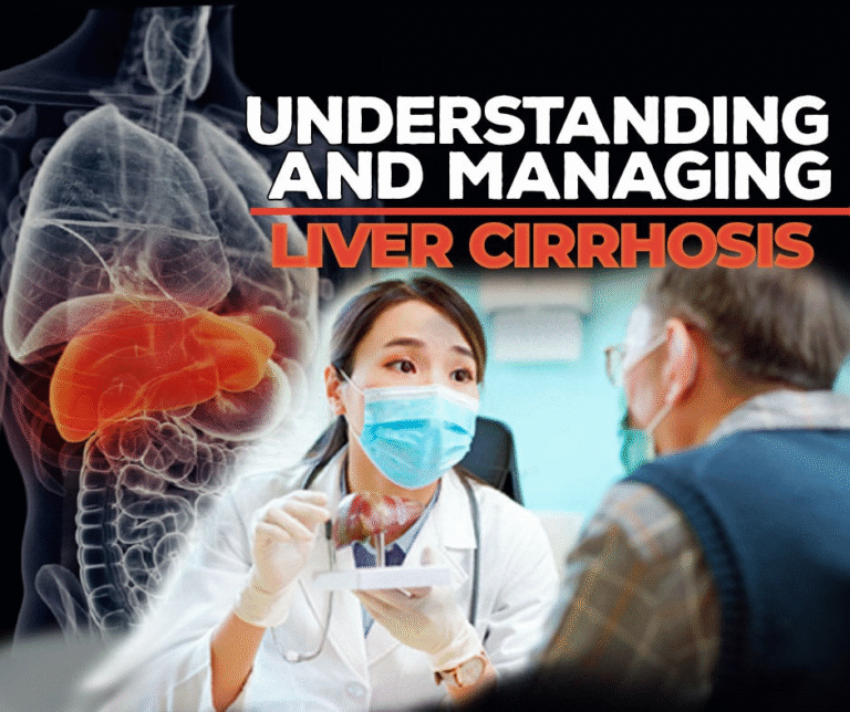 Understanding and Managing Cirrhosis of the Liver: A Guide for Patients and Caregivers.