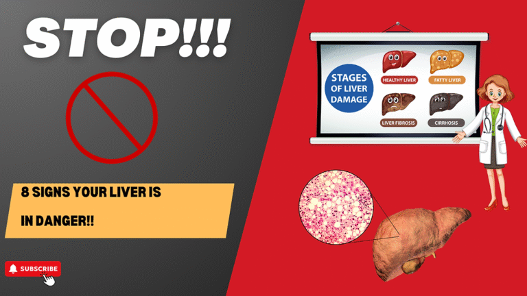 Recognising the Silent Signs of Fatty Liver Disease.