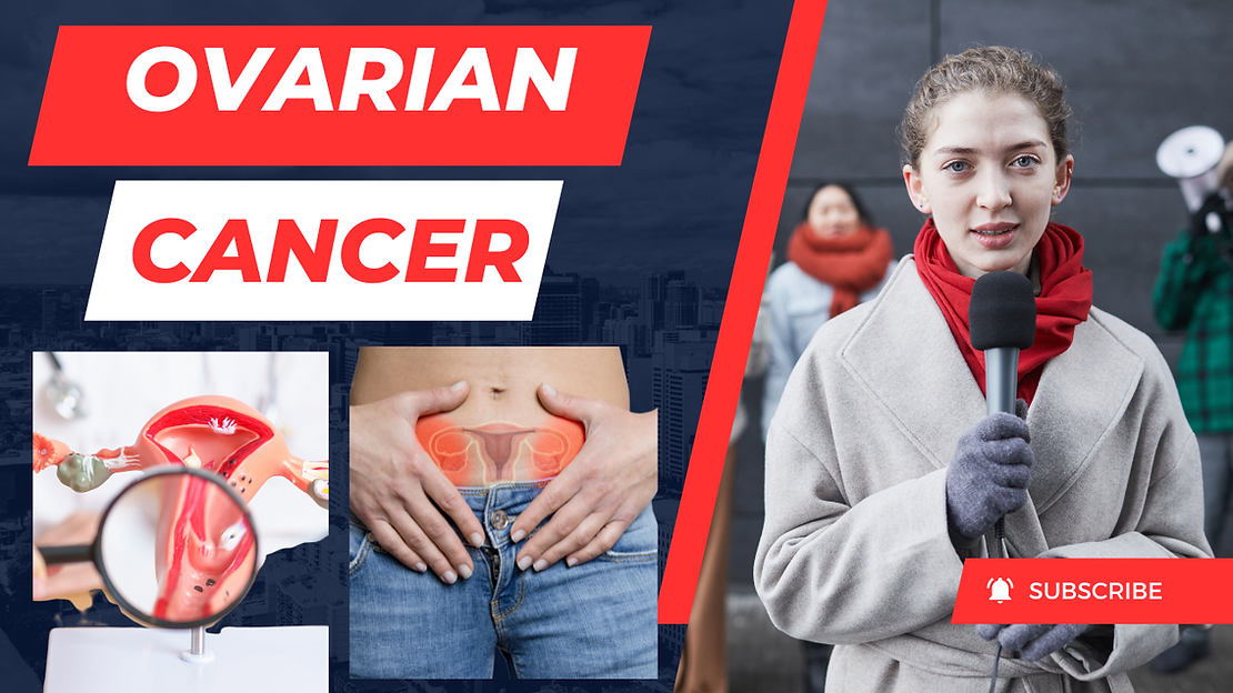 OVARIAN CANCER: AN OVERVIEW