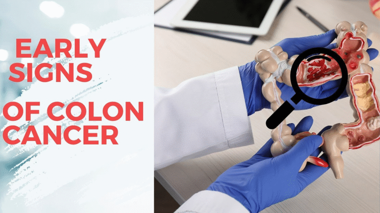 UNDERSTANDING EARLY SYMPTOMS OF COLON CANCER: A LIFESAVER GUIDE