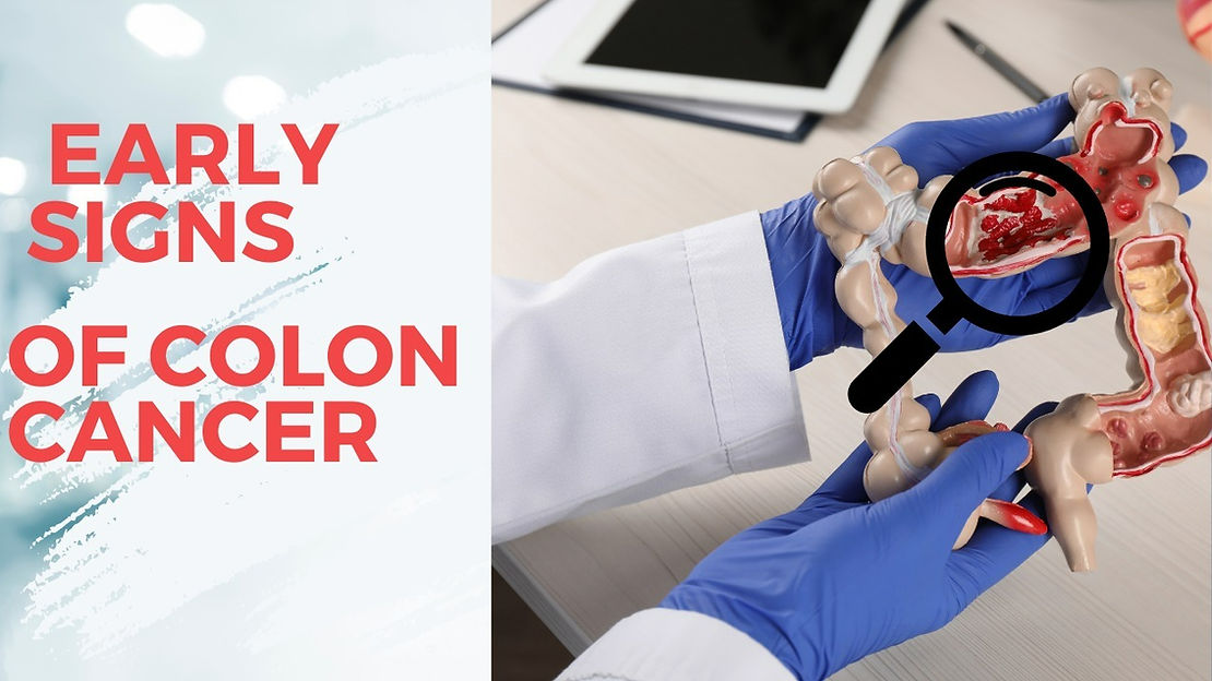 UNDERSTANDING EARLY SYMPTOMS OF COLON CANCER: A LIFESAVER GUIDE