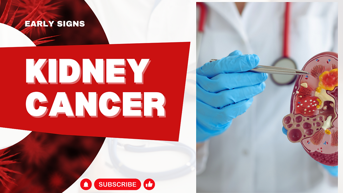 UNDERSTANDING KIDNEY CANCER: A comprehensive guide